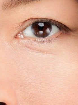 Tratamento Para Rejuvenescimento
