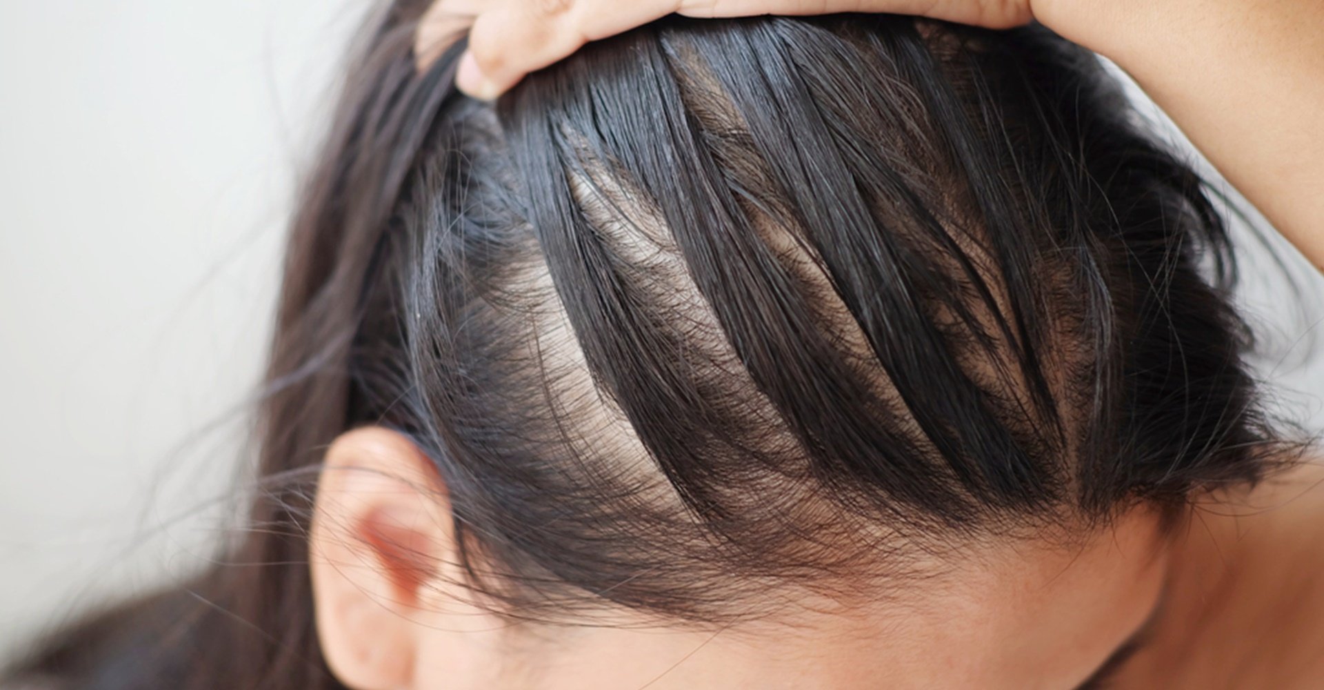 Entenda como cuidar do couro cabeludo oleoso