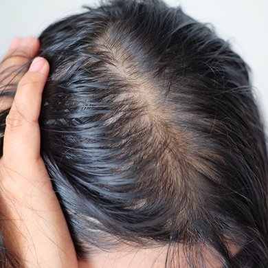 A hidratação facial ajuda no tratamento de manchas da pele