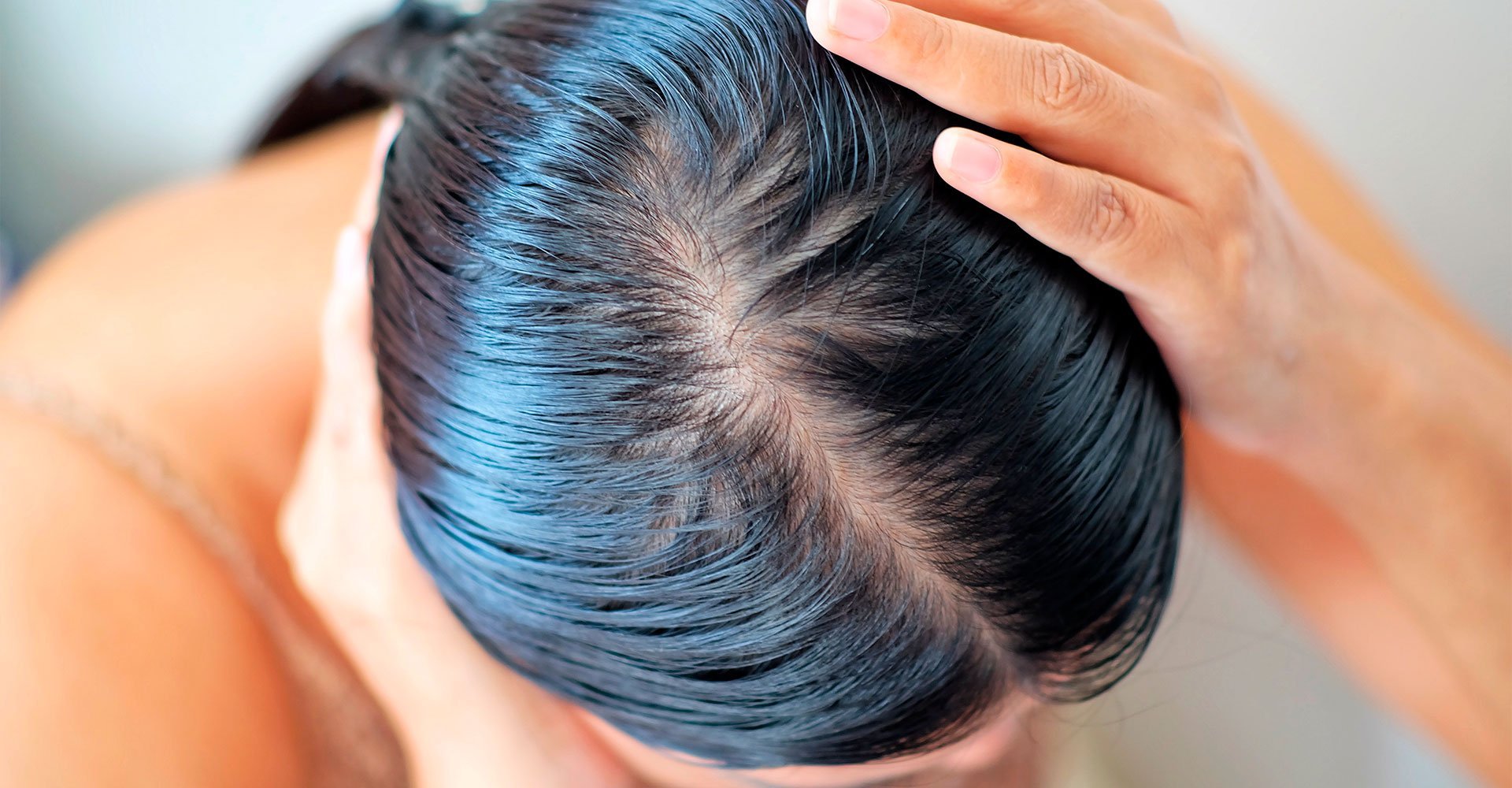 Quantas vezes por semana devo lavar cabelo oleoso?