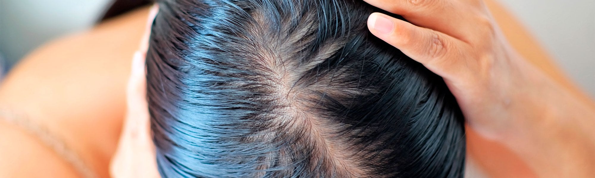 Quantas vezes por semana devo lavar cabelo oleoso?
