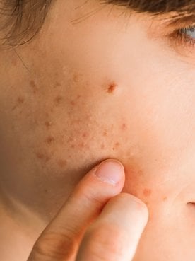 Entenda quais são as causas da alergia na pele