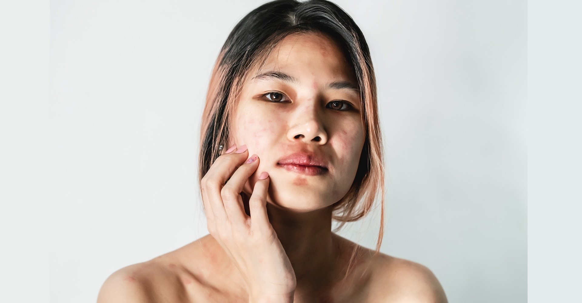 Coceira na pele: o que causa e como tratar