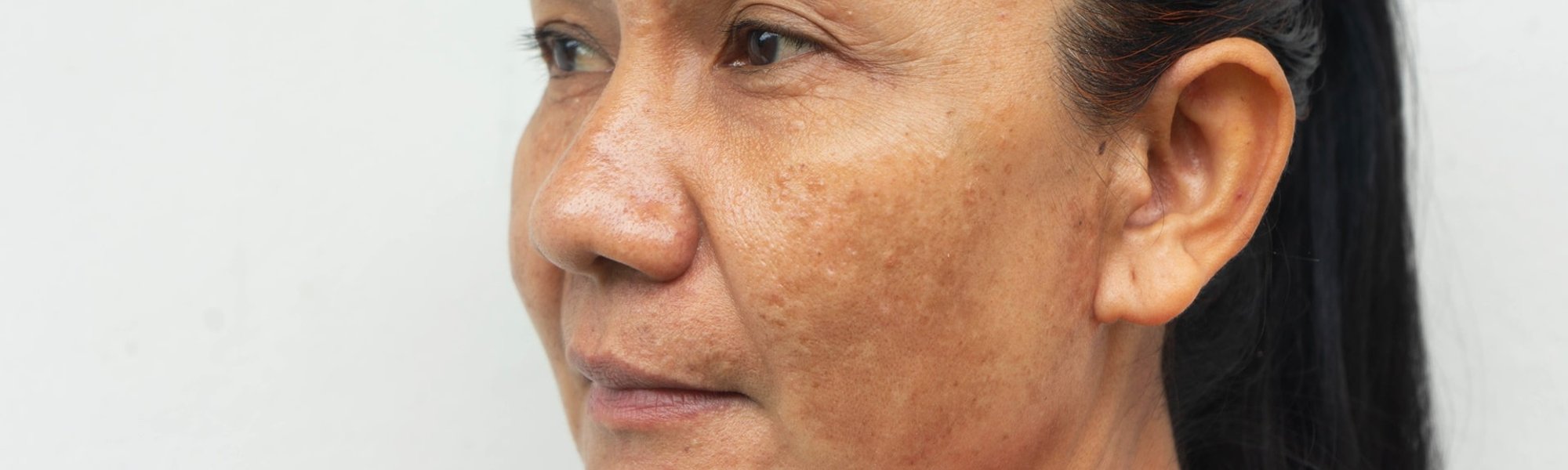 Cuidados com a pele na menopausa: dermatologista explica como montar sua rotina