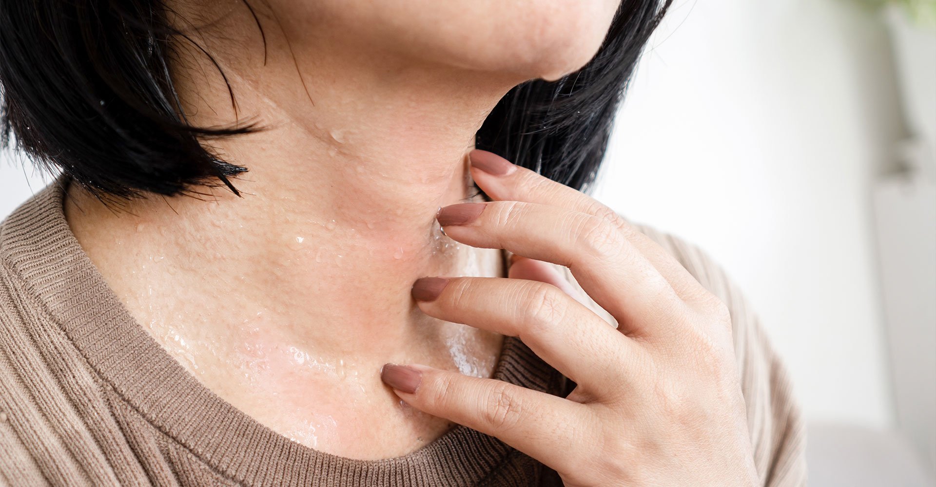 Uma mulher toca em sua pele suada e irritada, buscando alívio dos sintomas desconfortáveis da alergia ao calor