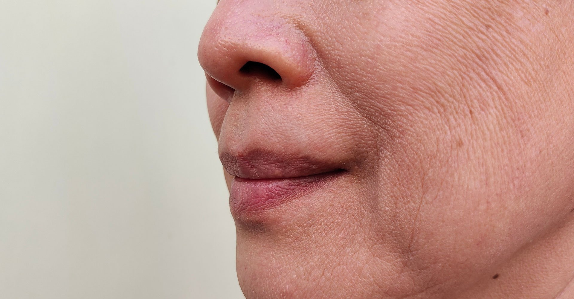 Mulher branca com sorriso de lado mostrando o bigode chinês