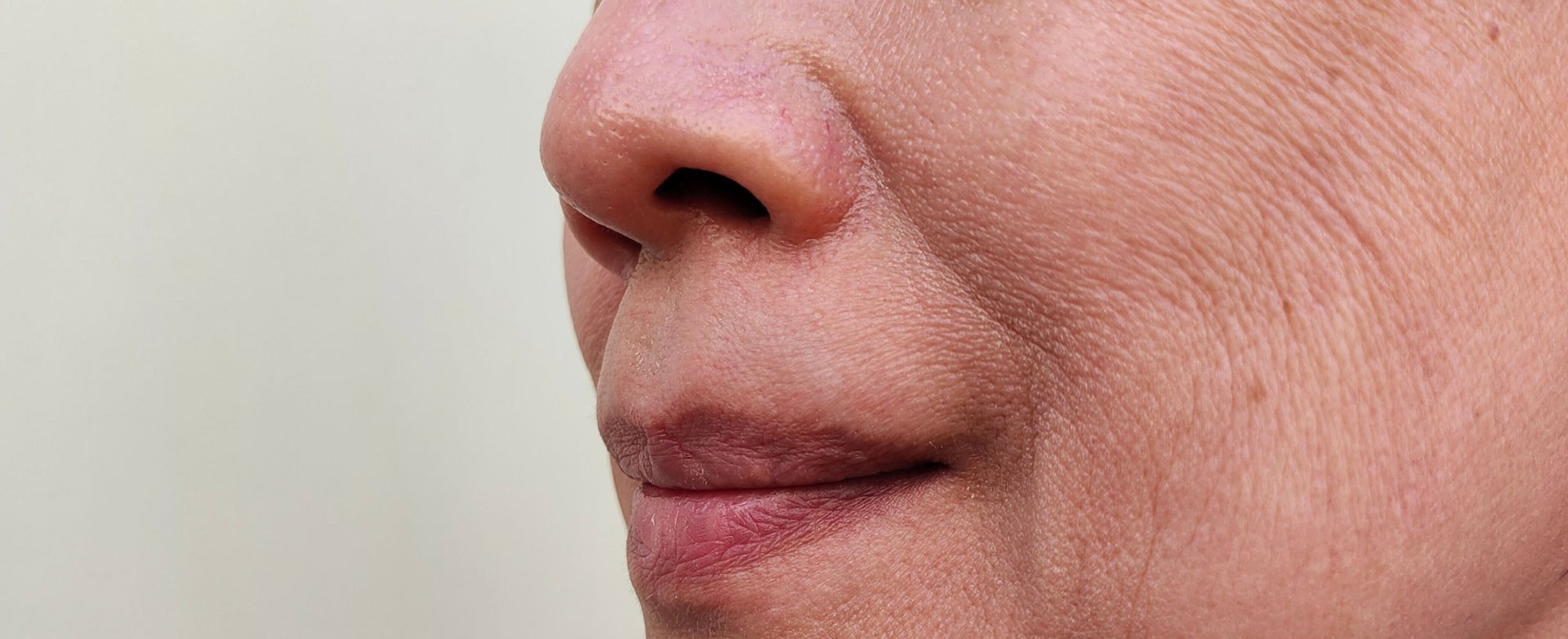 Mulher branca com sorriso de lado mostrando o bigode chinês