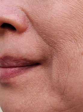 Mulher branca com sorriso de lado mostrando o bigode chinês
