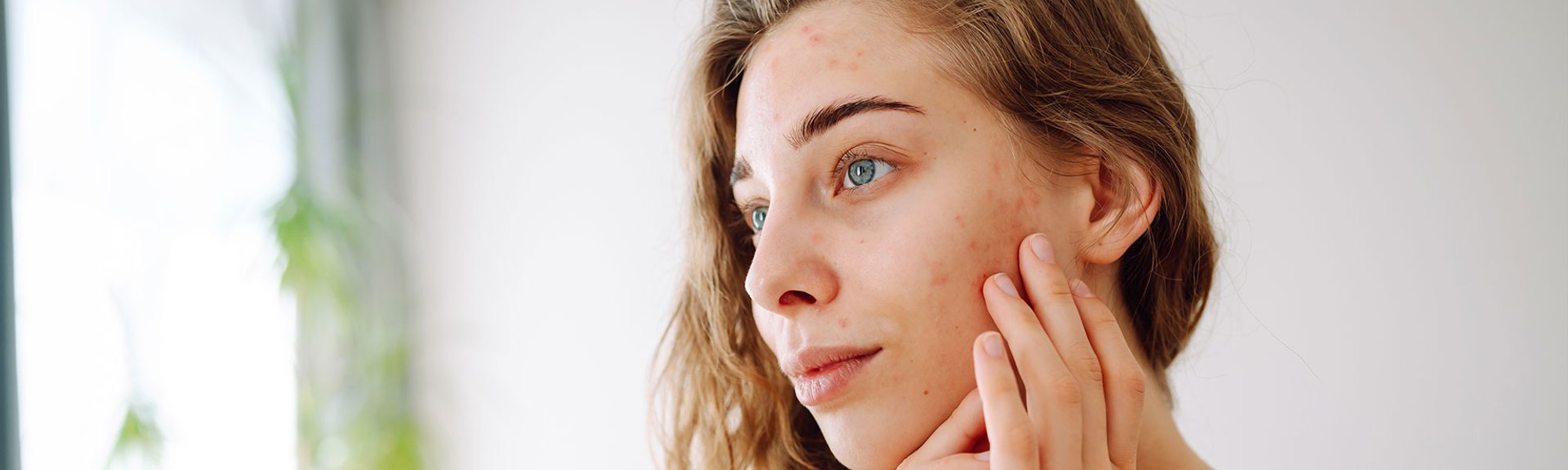 Mulher jovem passando creme para tirar manchas do rosto