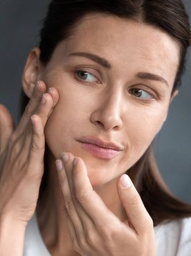 Manchas De Acne
