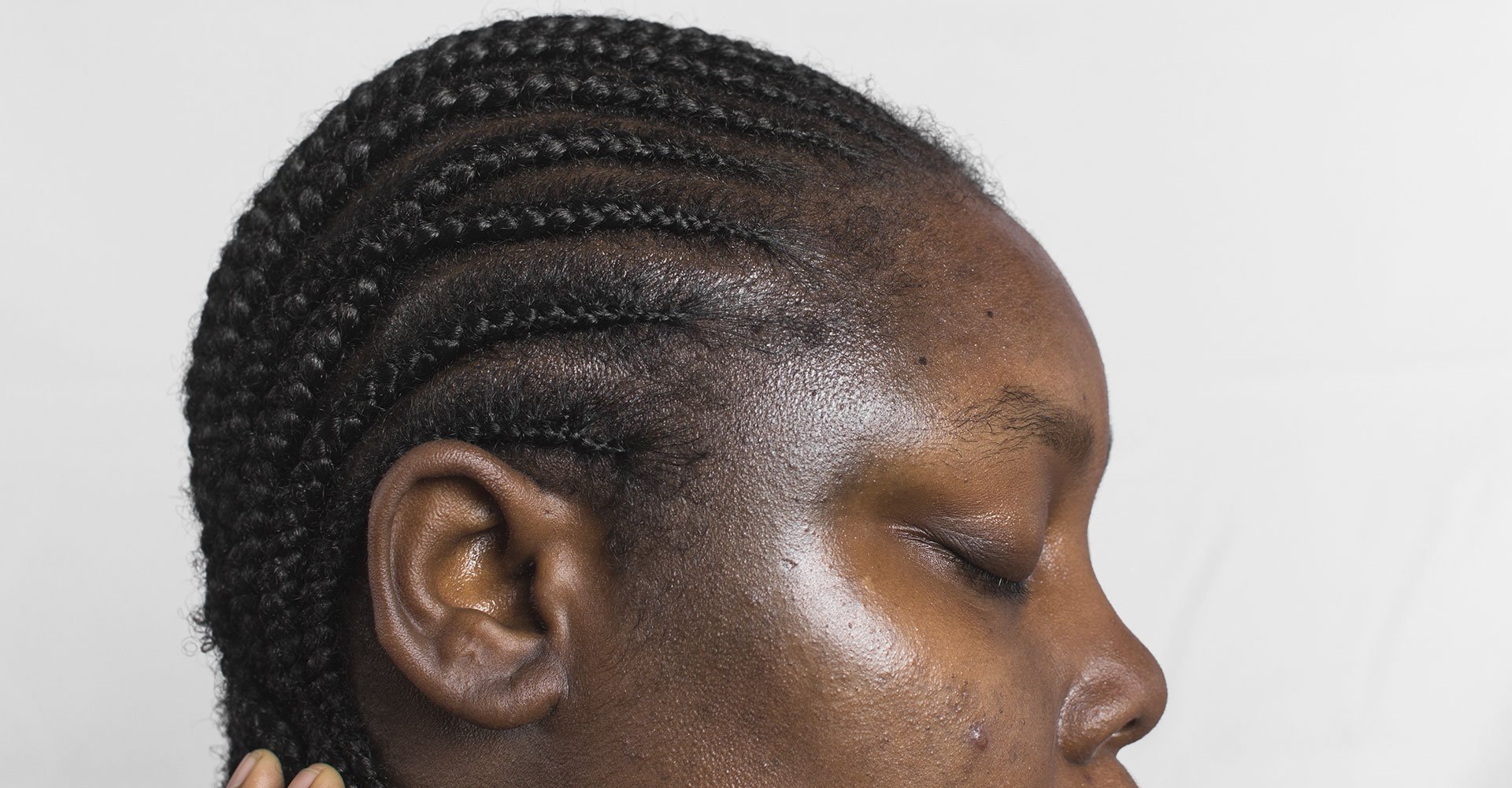 Mulher de perfil com manchas marrons na pele