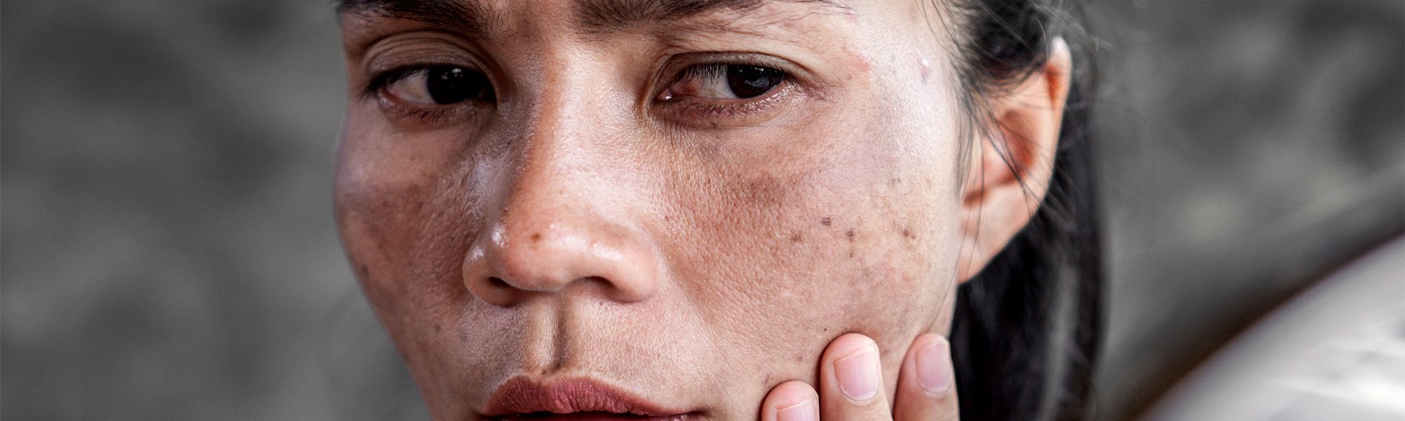 Mulher asiática observa sua pele do rosto no espelho e se pergunta: como tratar e clarear as manchas do rosto?