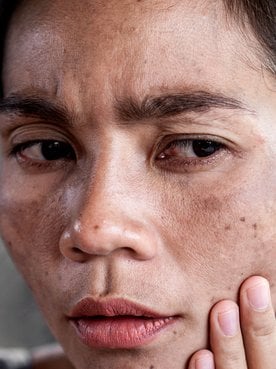 Mulher asiática observa sua pele do rosto no espelho e se pergunta: como tratar e clarear as manchas do rosto?