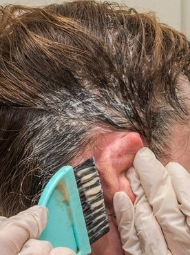 Pessoa usando luvas brancas aplicando tintura de cabelo perto da orelha e linha do cabelo de alguém com cabelos castanhos