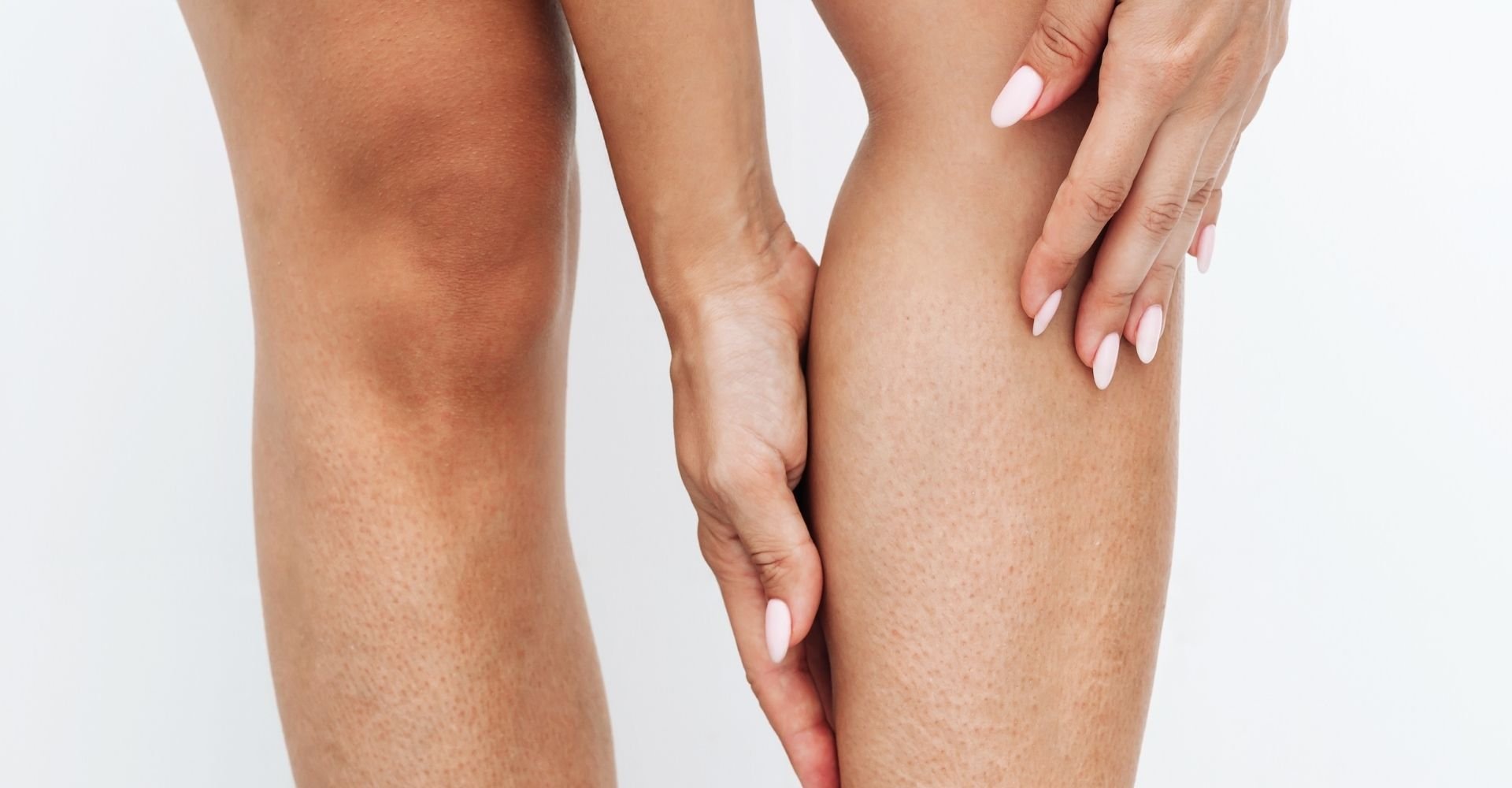 Mulher com as mãos em sua panturrilha que está com a pele irritada após depilação.