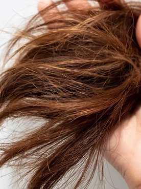Imagem Mostrando Cabelo Danificado