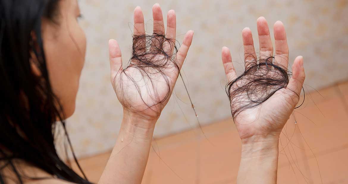 Modelo com queda capilar