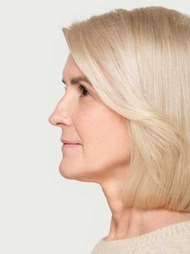 Modelo Idosa De Lado Com Cabelo Curto
