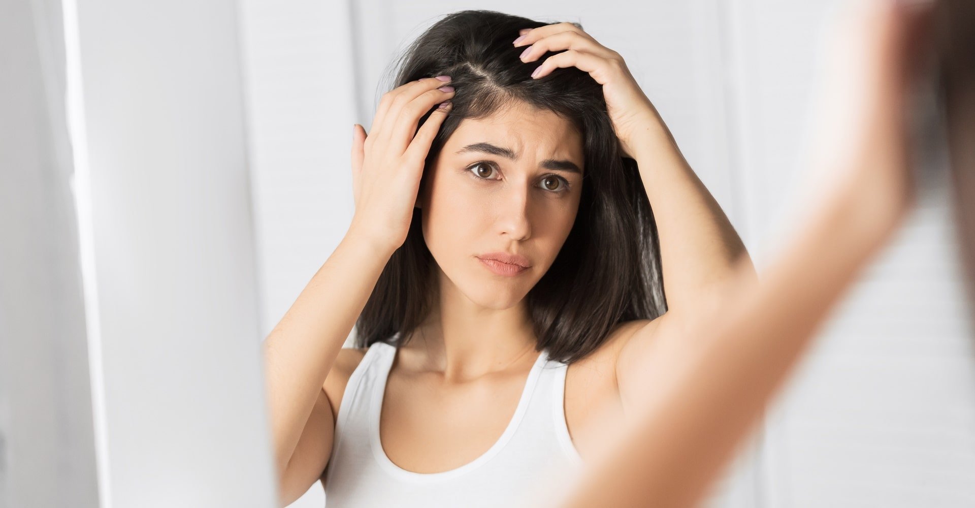 Caspa no cabelo: entenda o que é, o que causa e como tratar