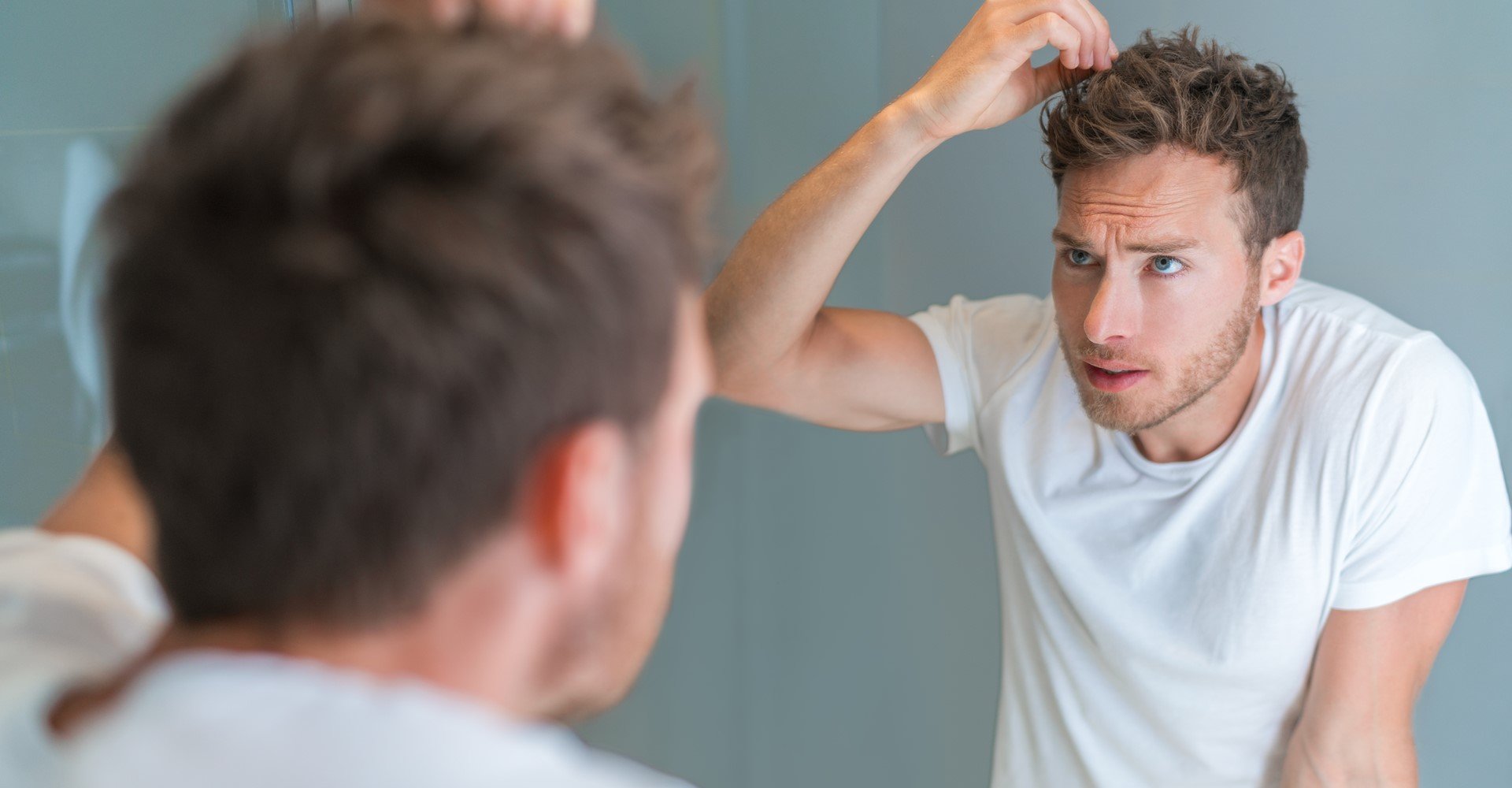 3415 Caspa No Cabelo Masculino Entenda O Que Causa O Problema E Saiba Como Tratar