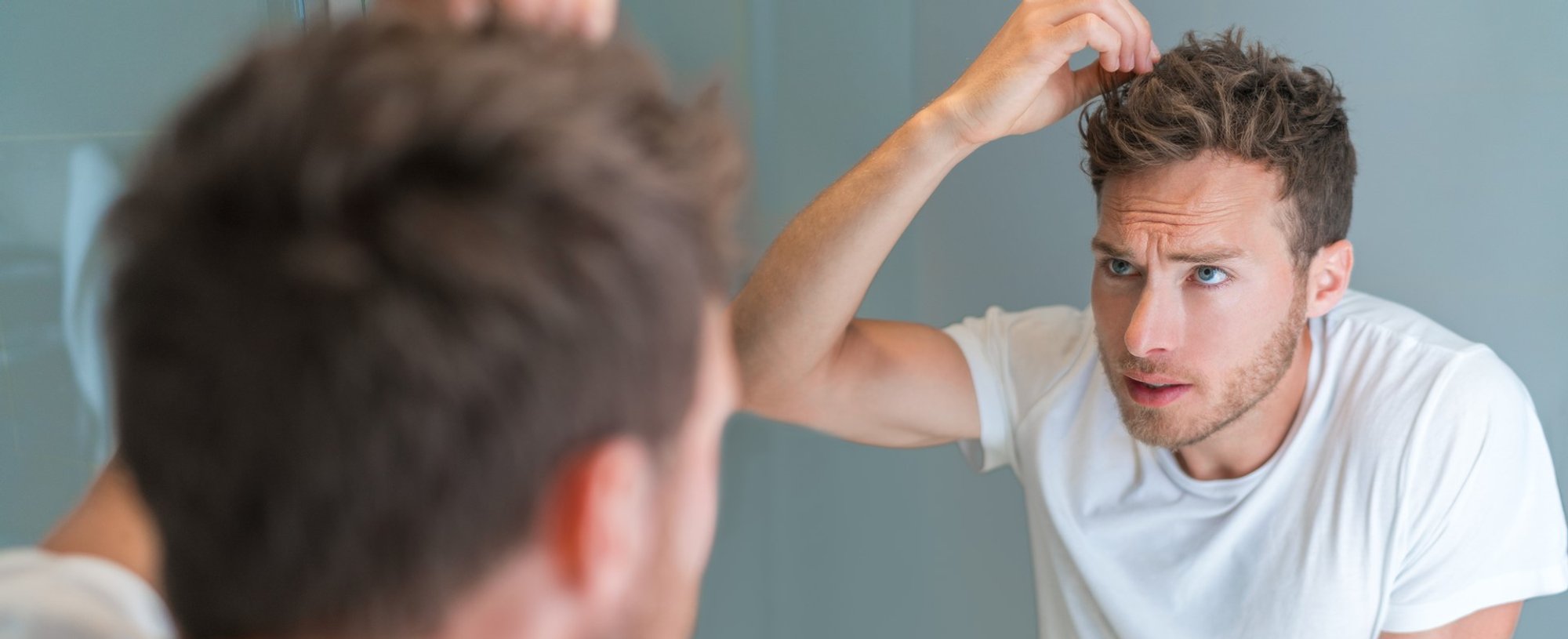 3415 Caspa No Cabelo Masculino Entenda O Que Causa O Problema E Saiba Como Tratar