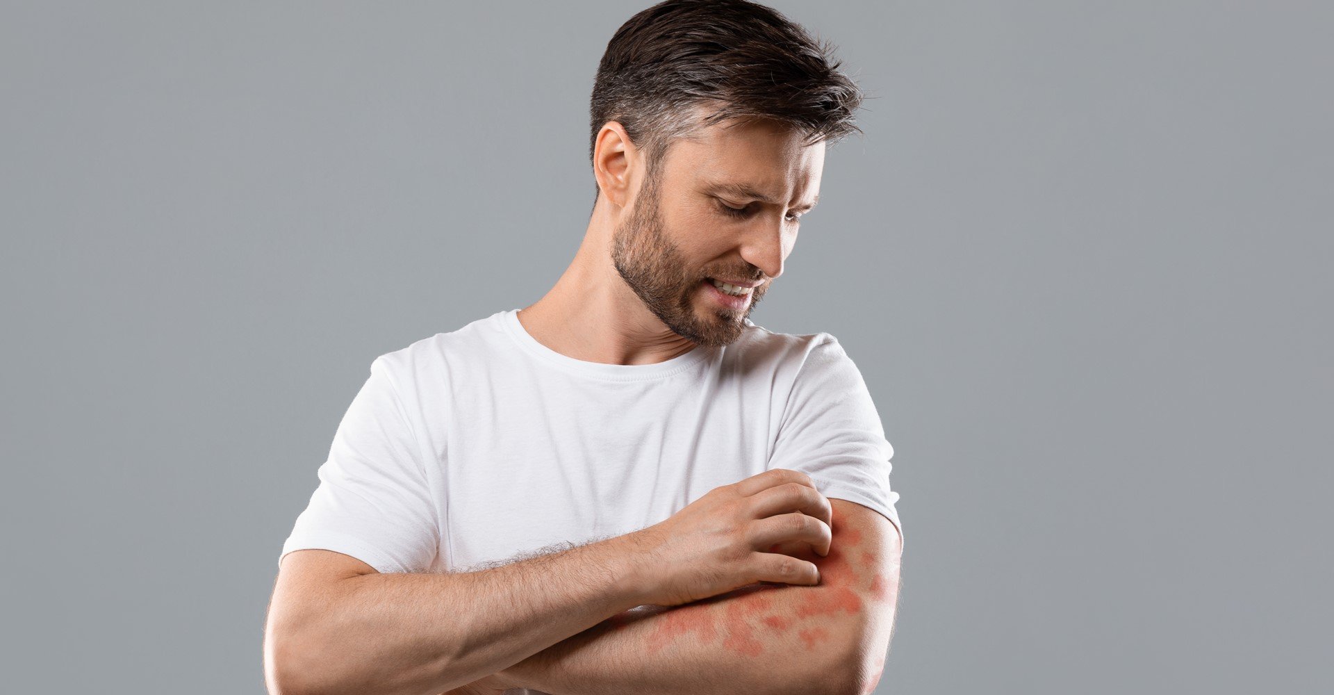 3480 Eczemaentendaoquecausaasinflamacoesnapeleevejadicasdeumadermatologistaparacuidardoproblema