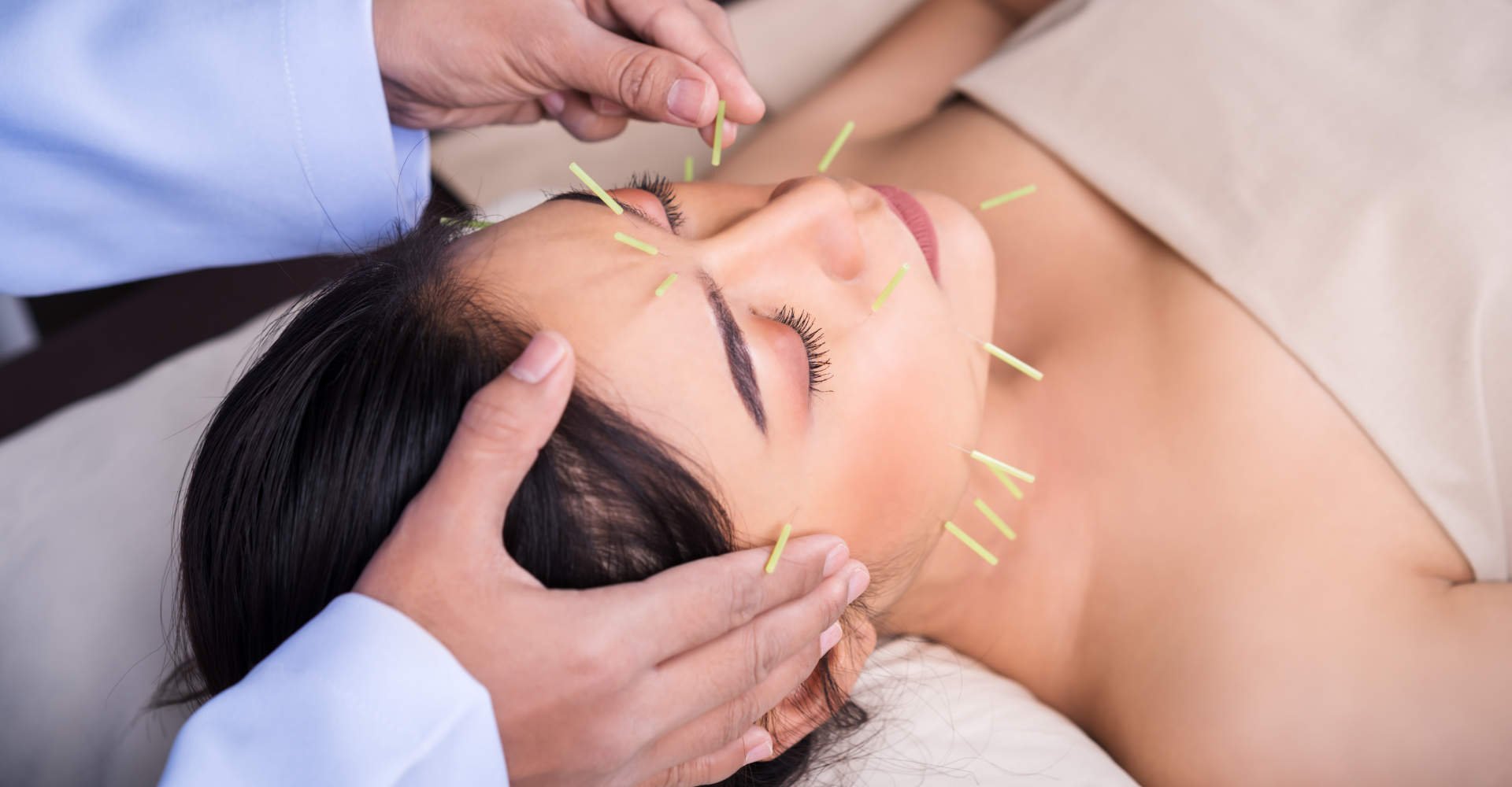 3537 Acupuntura Saiba O Que E E Para Que Serve A Terapia Milenar Feita Com Agulhas