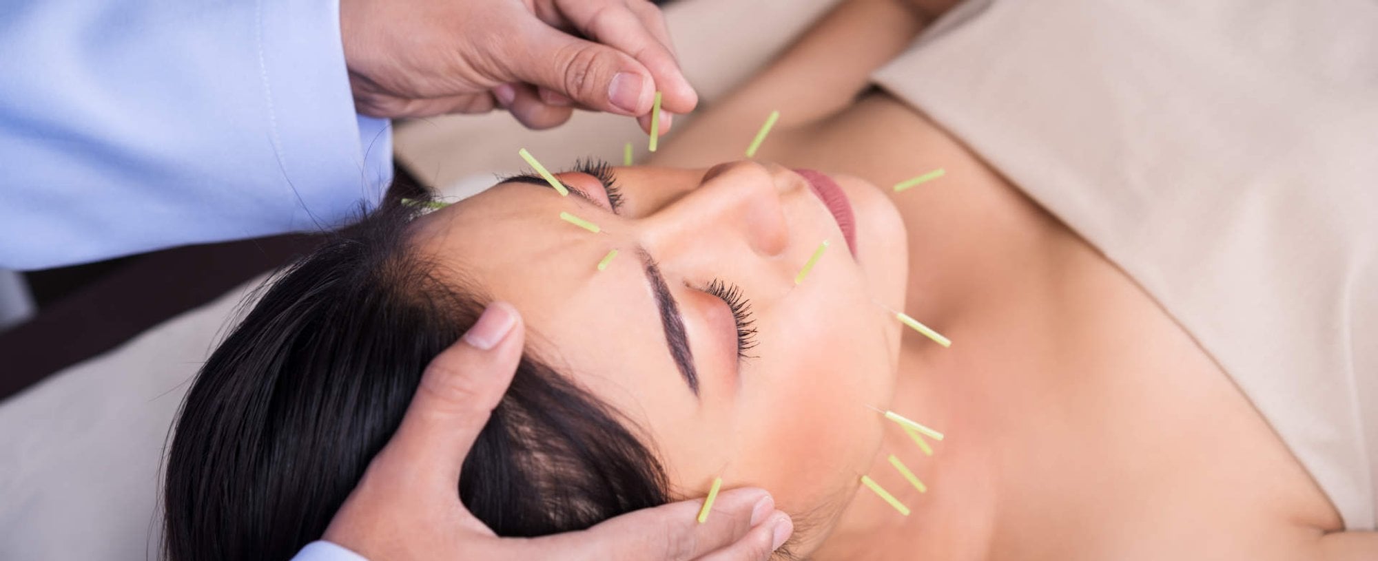 3537 Acupuntura Saiba O Que E E Para Que Serve A Terapia Milenar Feita Com Agulhas