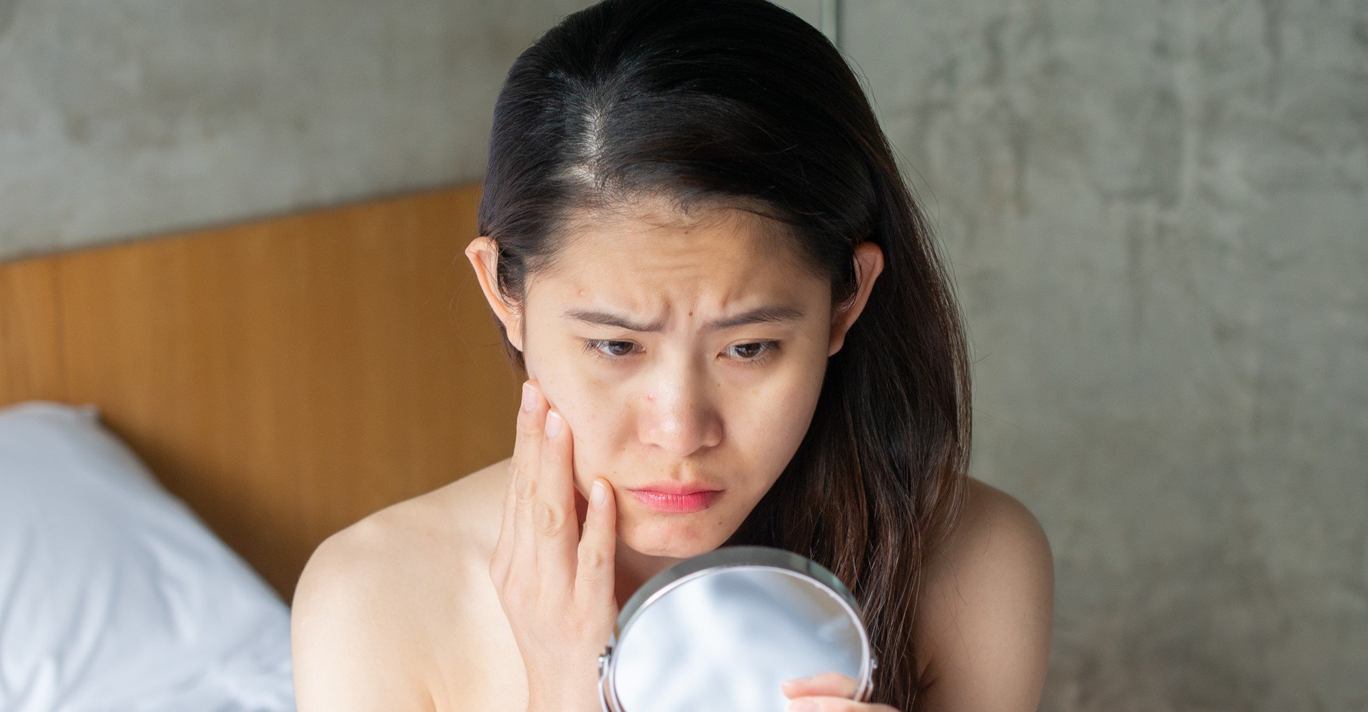 3736 Pintas Vermelhas Na Pele Do Rosto Ou Do Corpo O Que Pode Ser Descubra