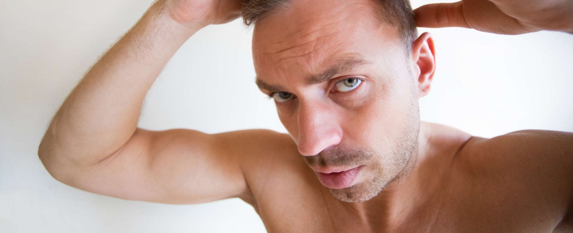 3778 Entradas No Cabelo E Normal Entenda Porque Elas Aparecem