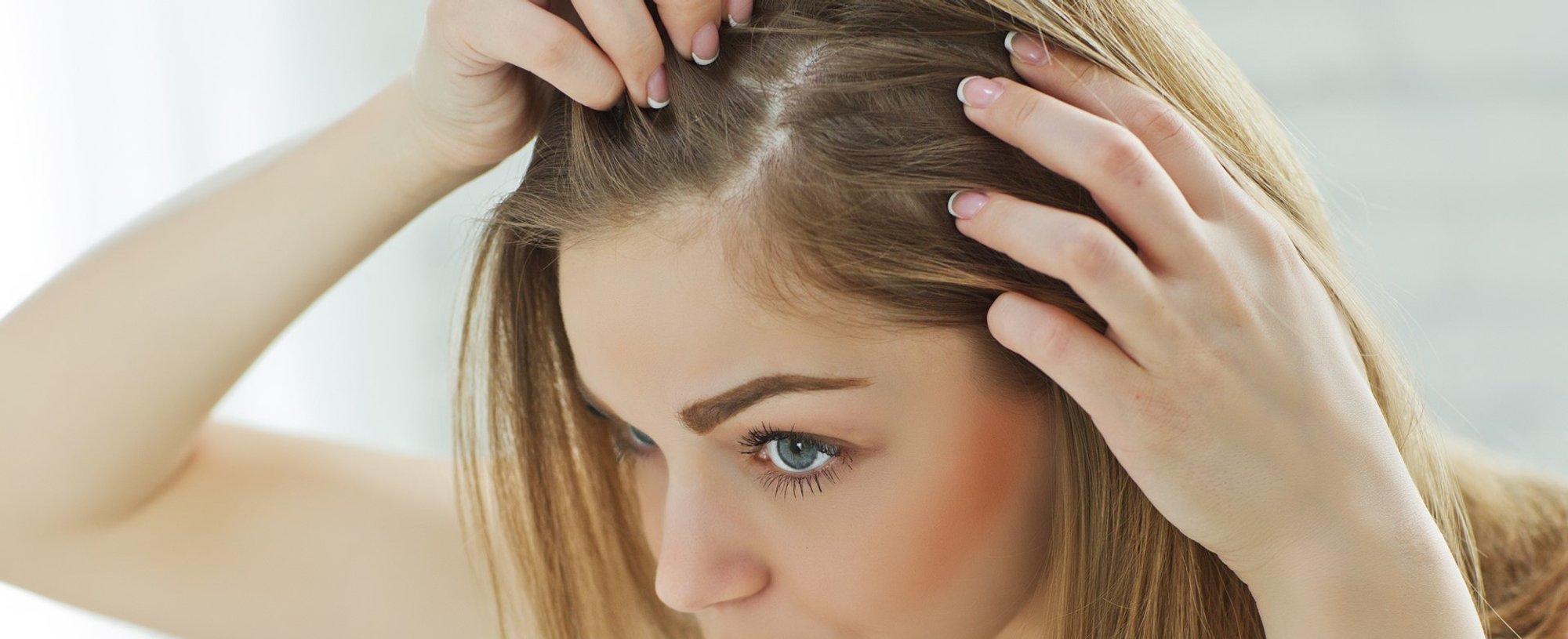 3807 Caspa Piora No Verao Ou No Inverno Tem Tratamento 3 Perguntas Respondidas