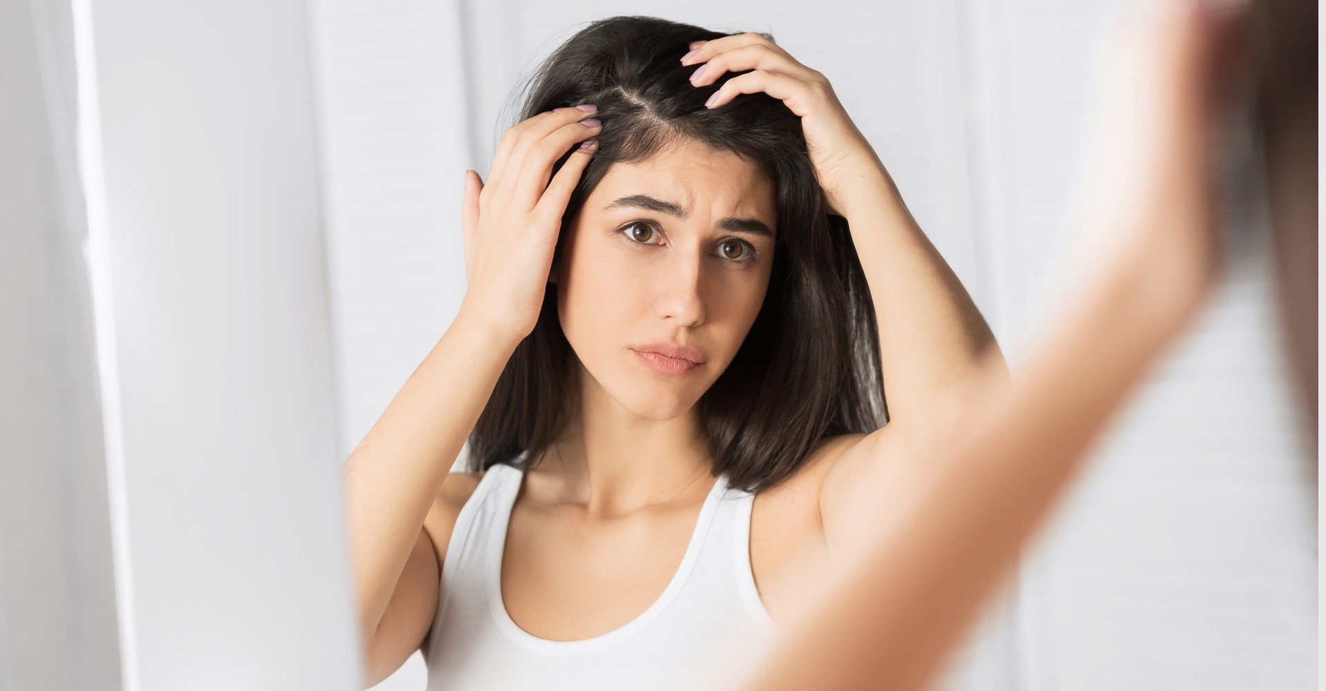 3855 Qual A Diferenca Entre Caspa E Couro Cabeludo Descascando Descubra