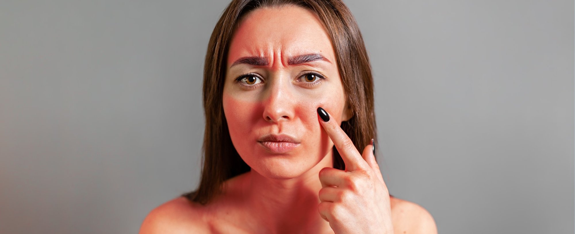 Modelo branca com manchas vermelhas pelo corpo