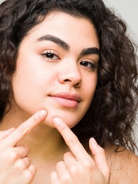Modelo branca apertando acne do seu rosto