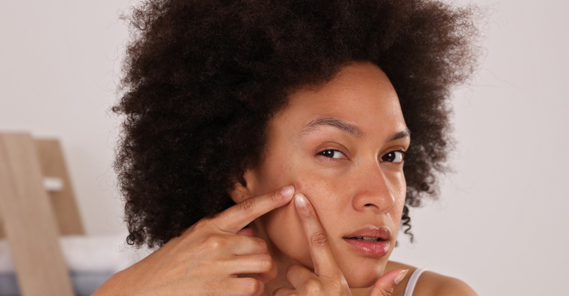 3972 5 Habitos Do Dia A Dia Que Podem Causar Espinhas No Rosto