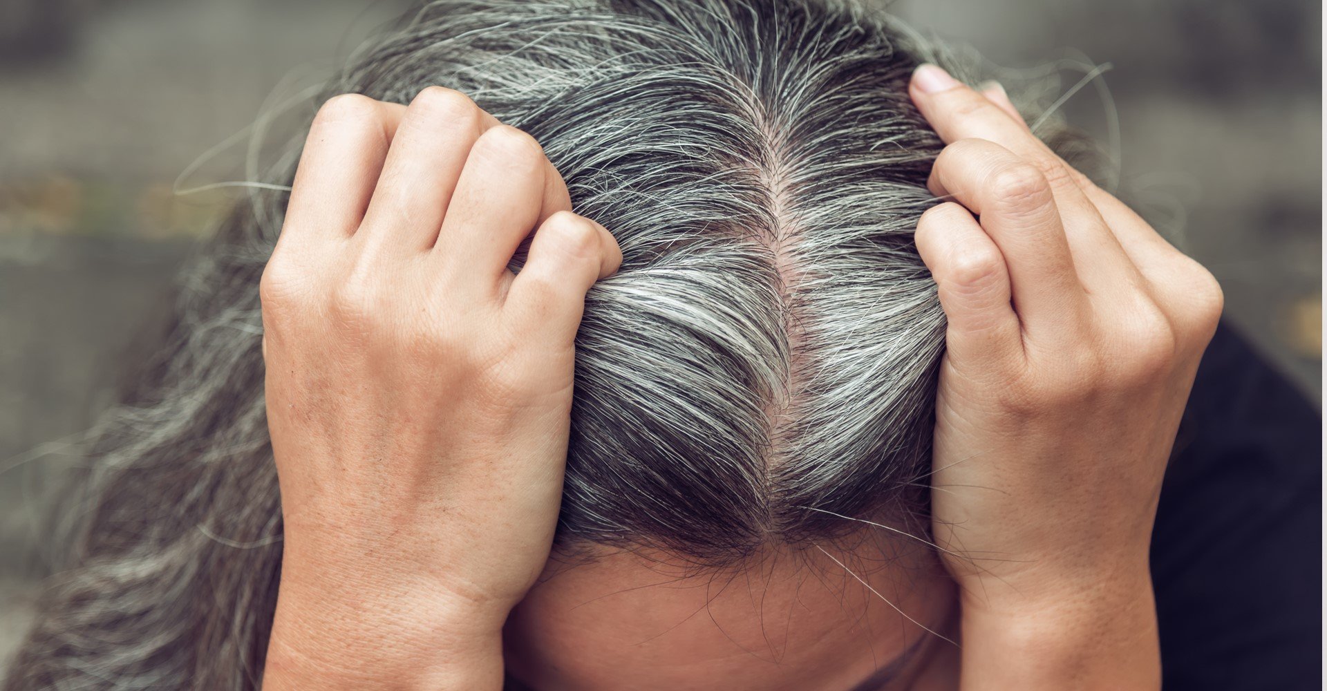 4630 Voce Sabia Que Cabelo Branco Pode Surgir Apos Um Choque Emocional