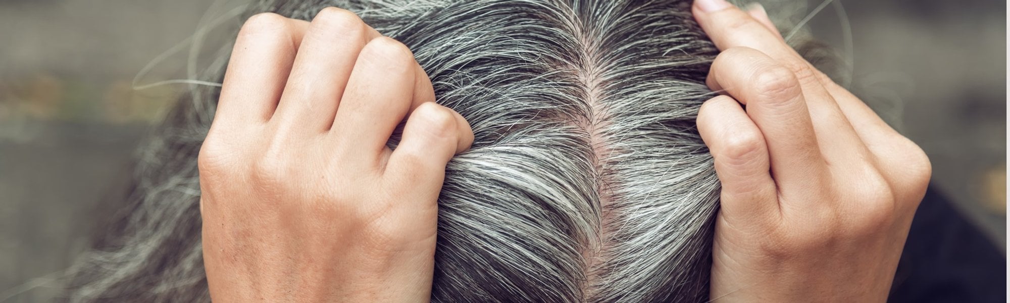 4630 Voce Sabia Que Cabelo Branco Pode Surgir Apos Um Choque Emocional