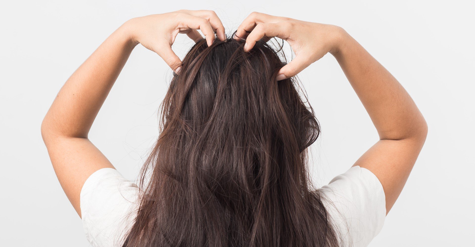 здоровая кожа головы. чесание головы. тянуть волосы. себорея волосяного покрова. зуд головы причины и лечение у женщин.