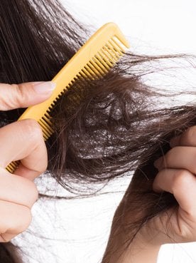 4687 Por Que O Cabelo Embaraca Saiba Como Evitar E Desfazer O No Nos Fios