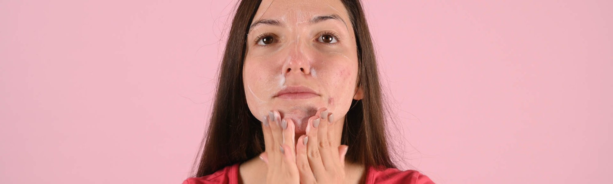 5469 Espinhas Inflamadas Como Cuidar Da Pele Com As Erupcoes Sem Piorar O Problema