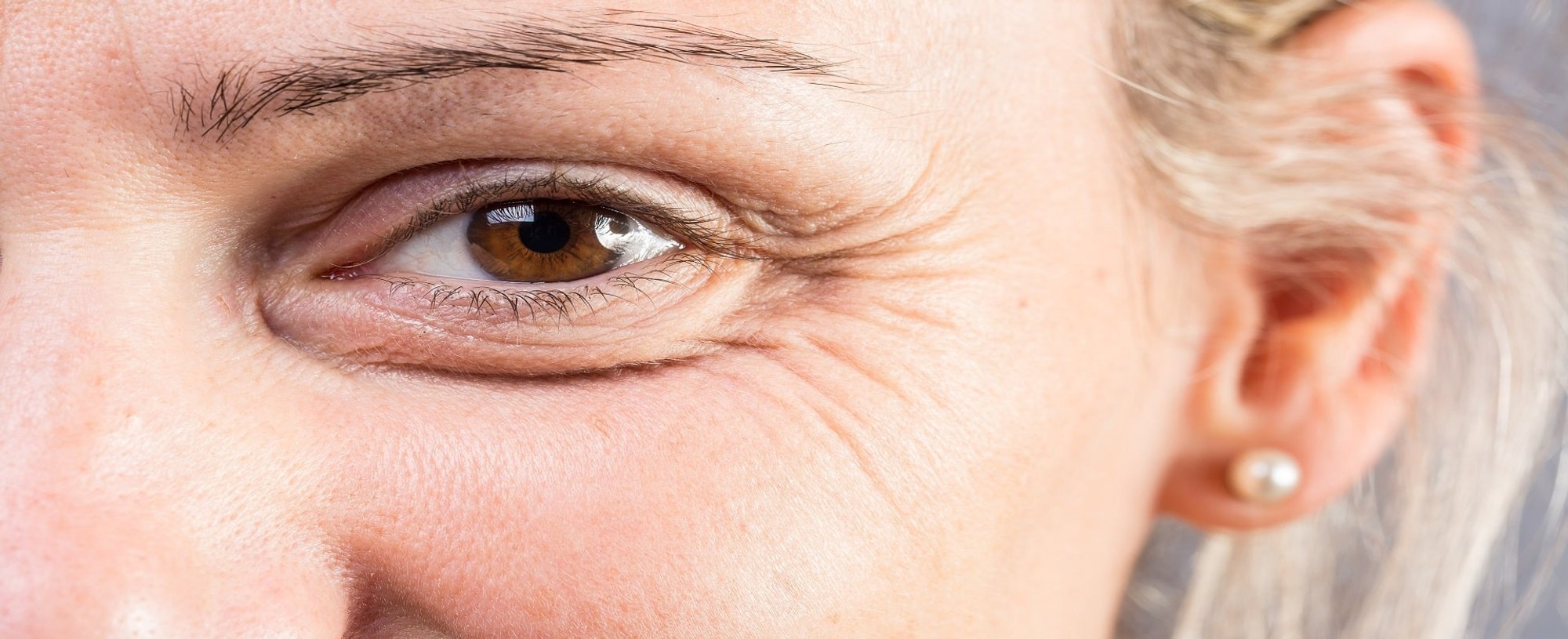 Ruga Nos Olhos