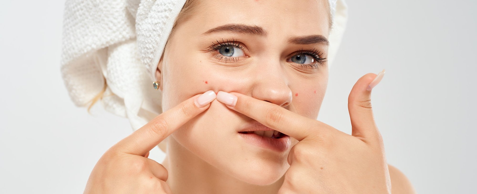 2449 O Que Causa A Espinha Interna E Como Elimina La Descubra Com As Dicas De Dermatologista