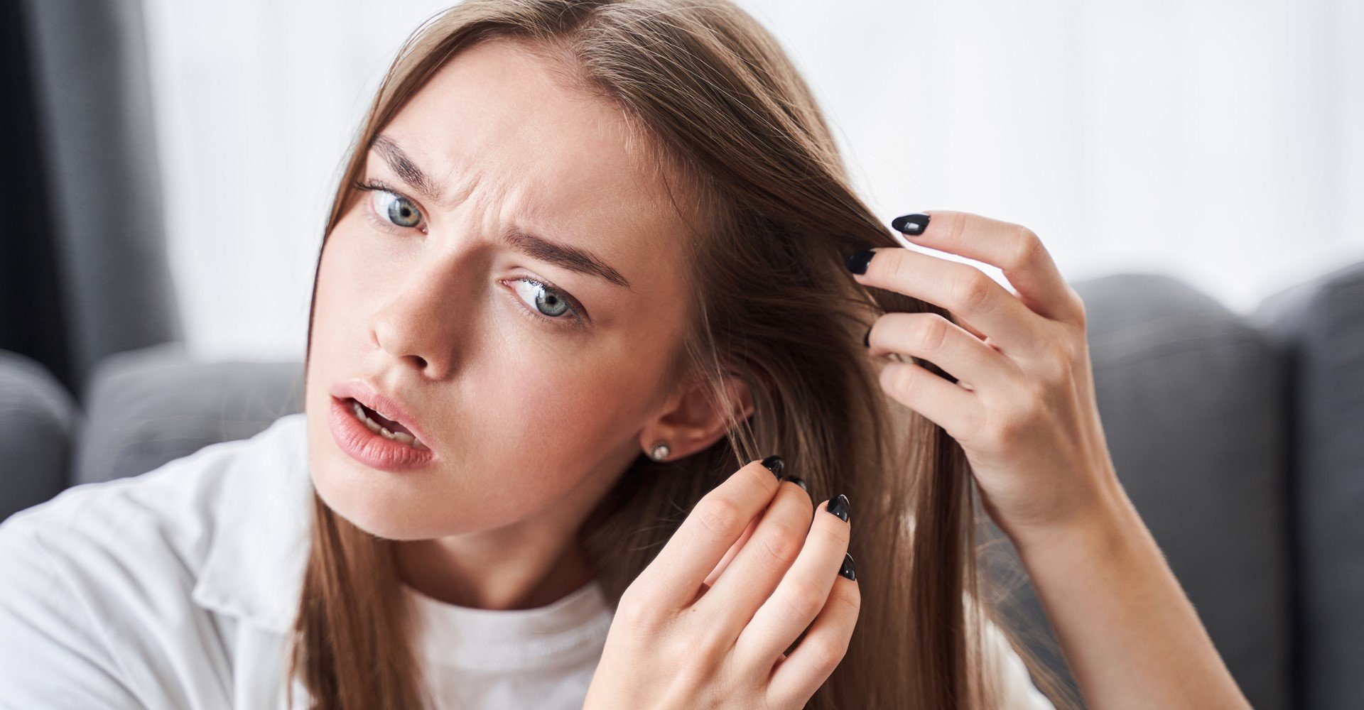 2773 Cabelo Caindo Da Raiz O Que Pode Ser Dicas De Como Tratar O Problema