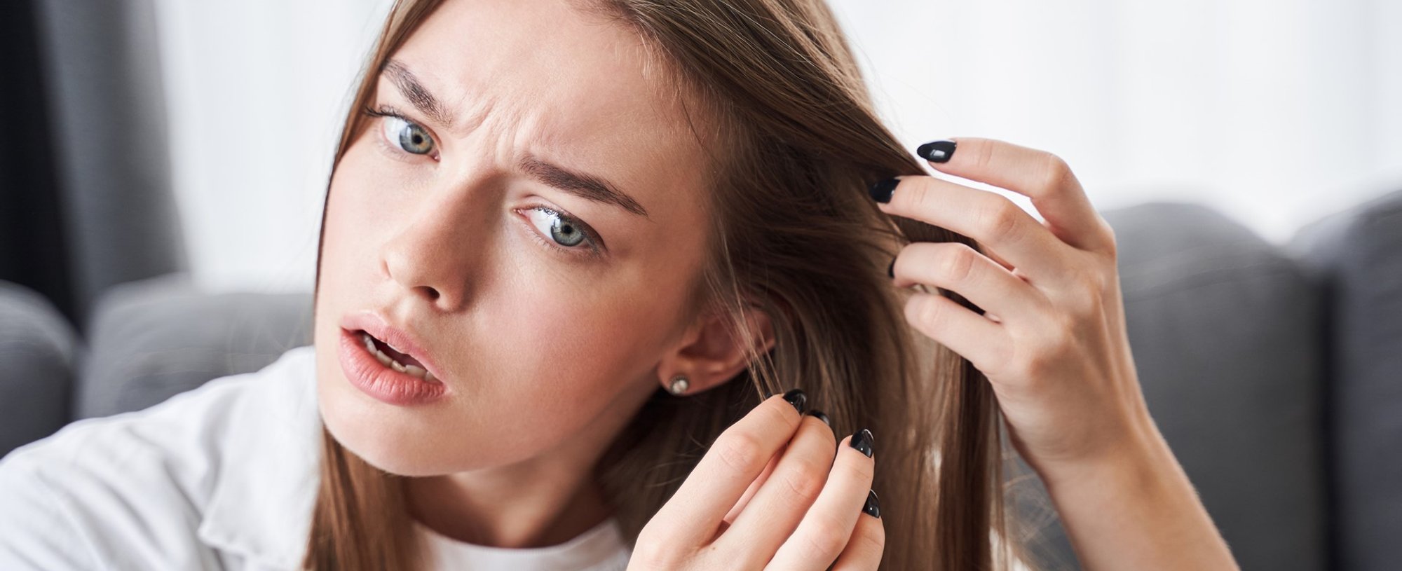 2773 Cabelo Caindo Da Raiz O Que Pode Ser Dicas De Como Tratar O Problema