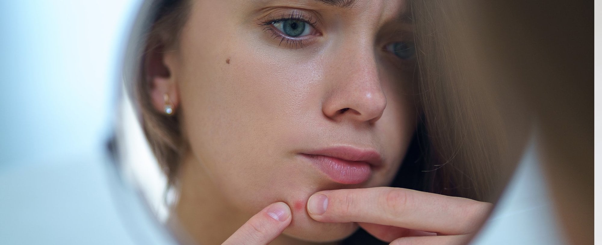 Modelo branca olhando pelo espelho acne em seus rosto