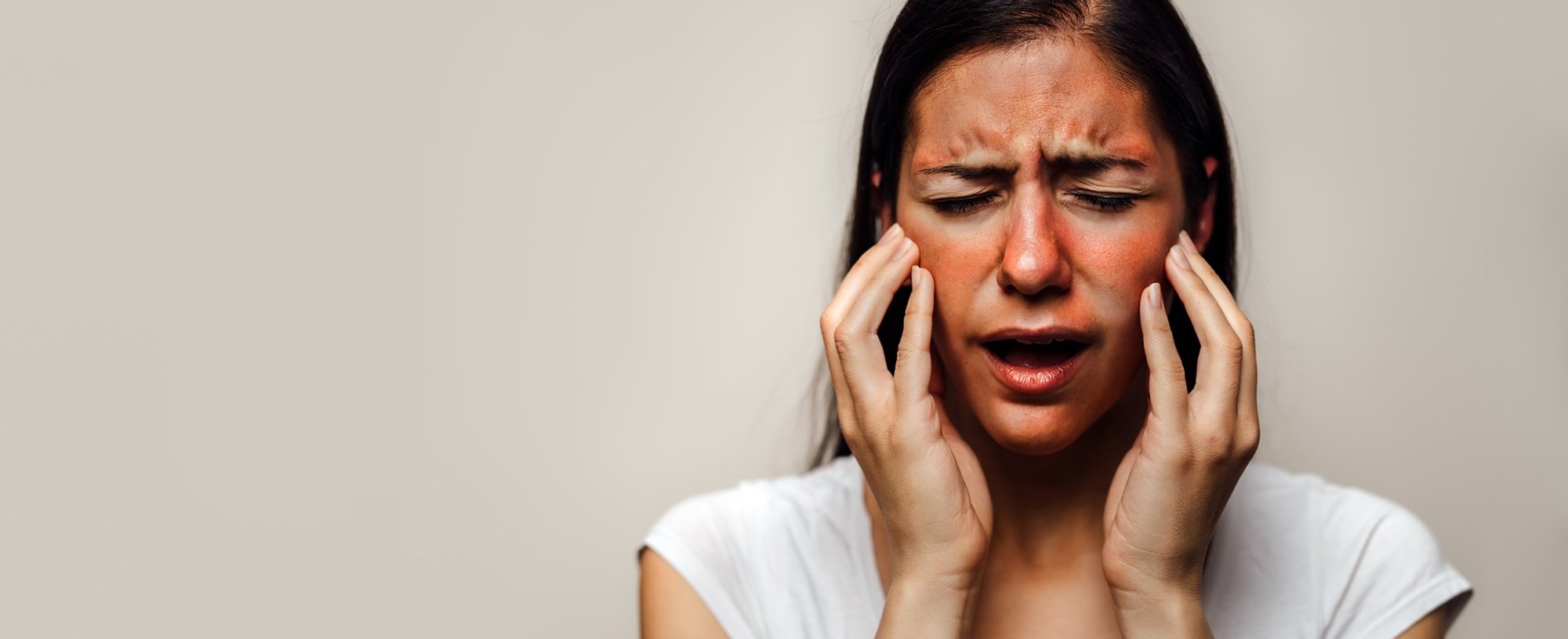 Modelo com manchas vermelhas no rosto e fazendo expressão de dor