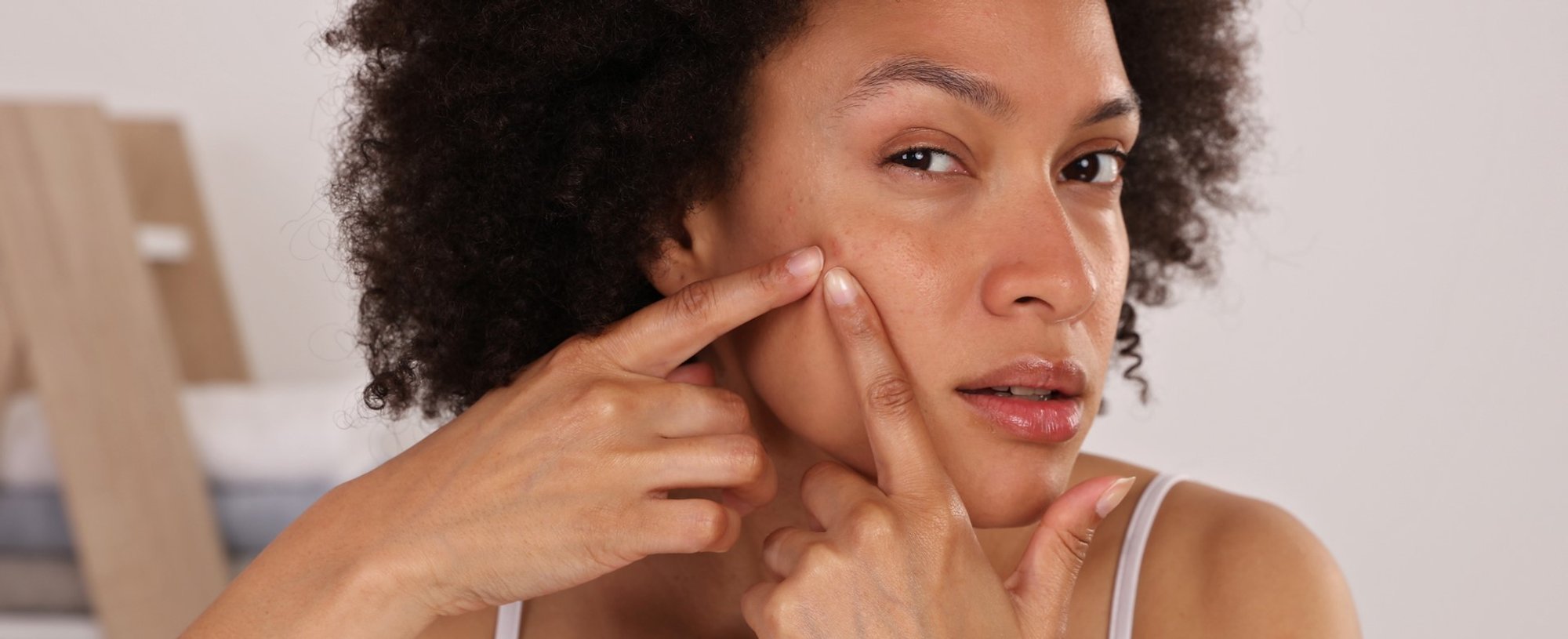 Modelo negra apertando acne do rosto