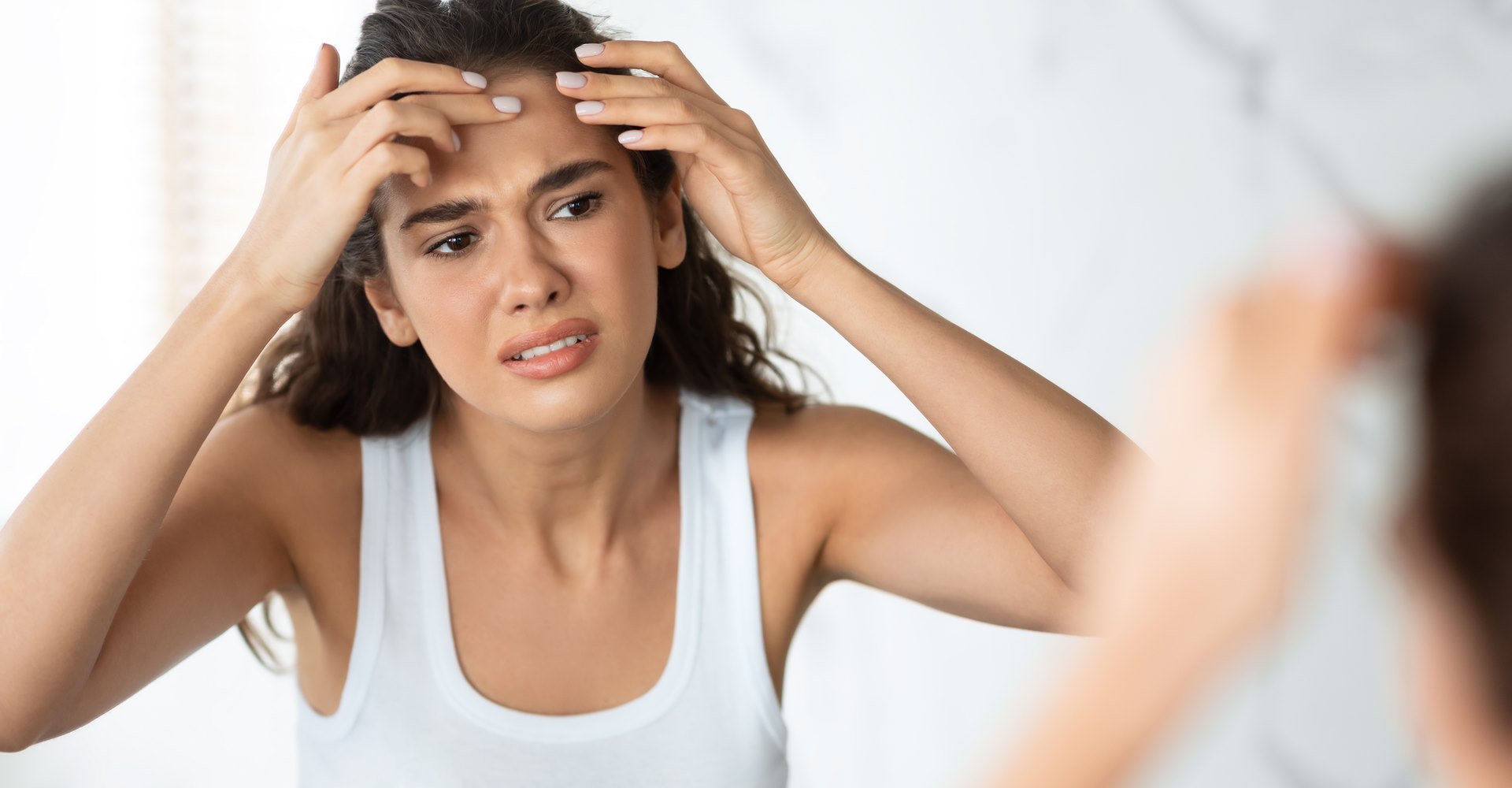 Modelo branca apertando acne do seu rosto 