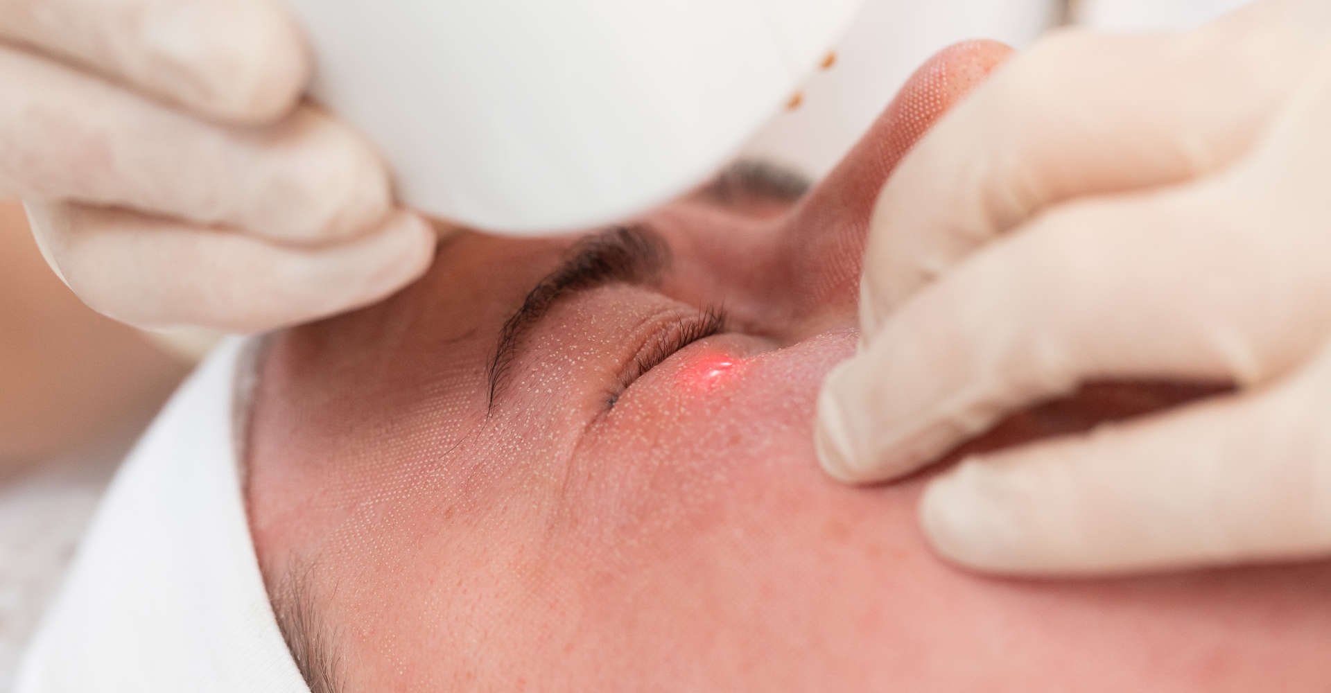 cirurgia estética a laser