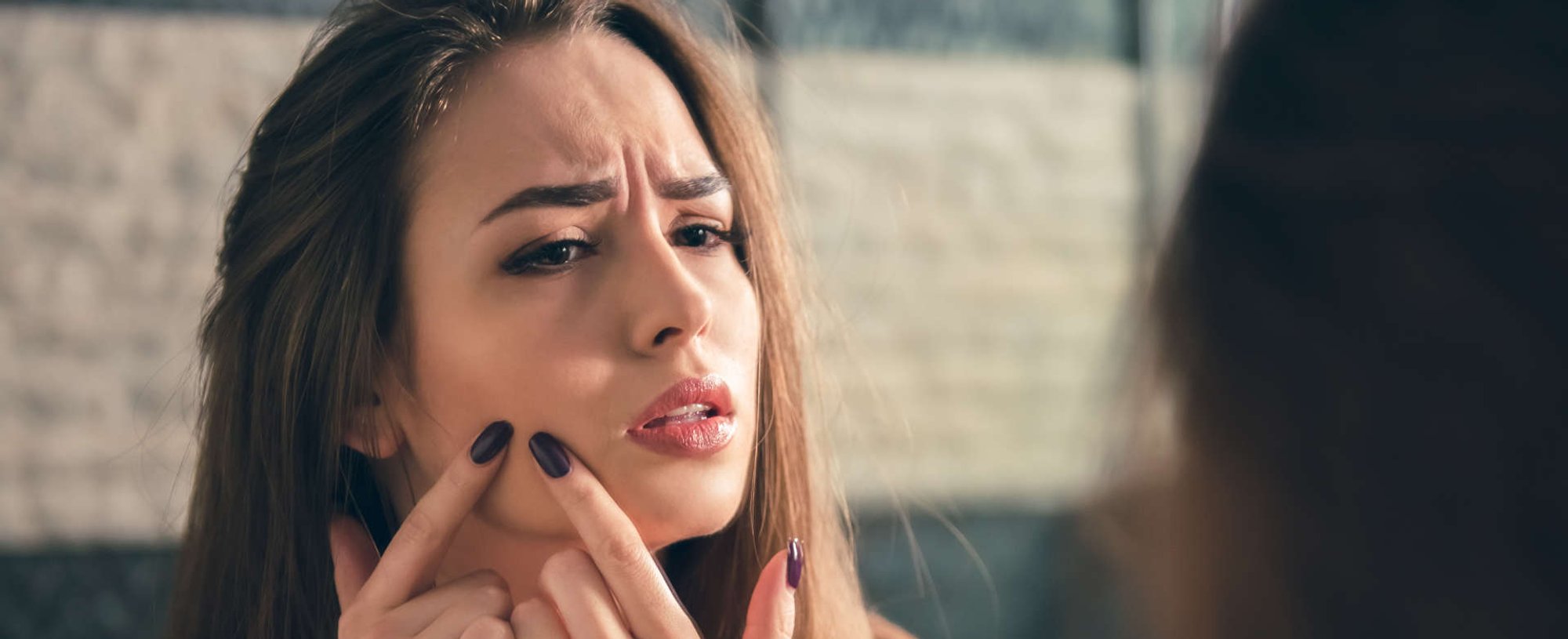 Acne Filtro Solar Cuidado Com Pele